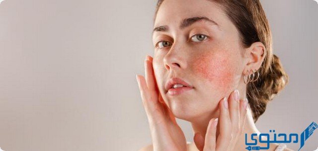 ديسلور Deslor لعلاج الحكة الجلدية
