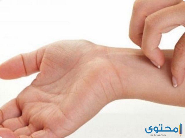 غلورا GLORA علاج الحساسية ومضاد للهيستامين